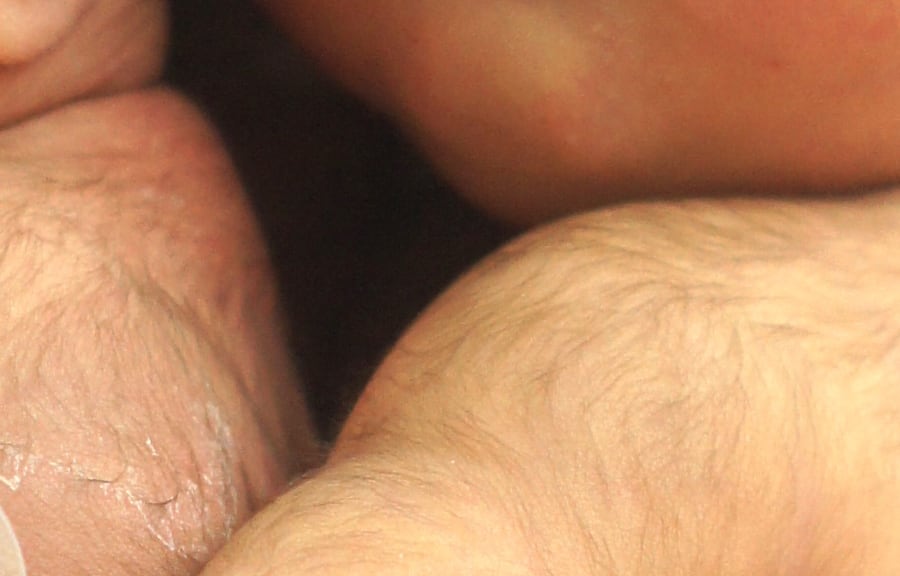 Close-up photograph of fine, pale hair on a newborn's shoulder and back